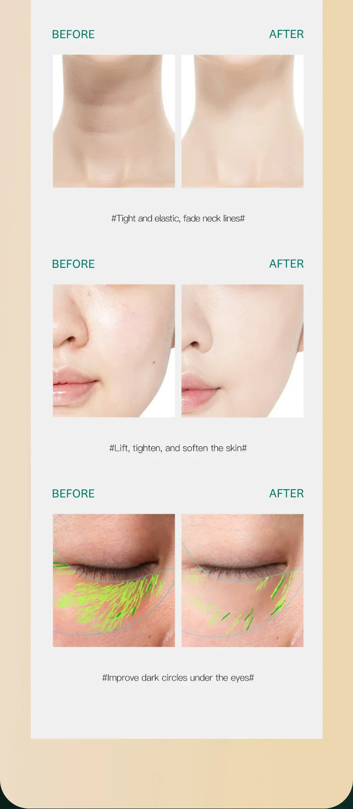 3-in-1 EMS Facial Lifting & Skin Tightening Device