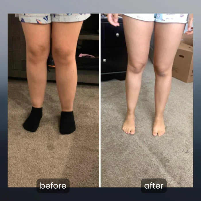 Leg Massager with Heat – Relief for Tired & Sore Legs.